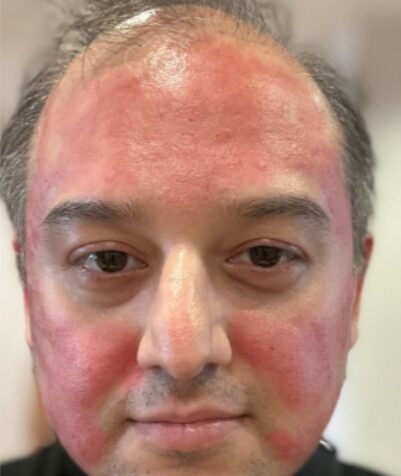 before-one